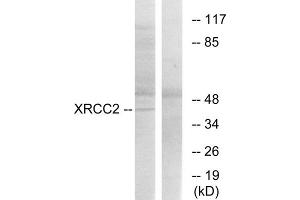 Western blot analysis of extracts from 293cells, using XRCC2 antibody. (XRCC2 Antikörper  (C-Term))