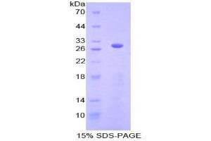 SDS-PAGE analysis of Human ACTC1 Protein. (ACTC1 Protein)