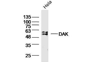 HeLa cell lysates probed with DAK Polyclonal Antibody, unconjugated (bs-20314R) at 1:300 overnight at 4°C followed by a conjugated secondary antibody for 60 minutes at 37°C. (DAK Antikörper  (AA 101-200))