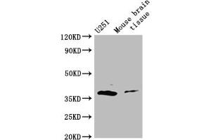 Western Blot Positive WB detected in: Mouse brain tissue All lanes: ADORA2B antibody at 3 μg/mL Secondary Goat polyclonal to rabbit IgG at 1/50000 dilution Predicted band size: 37 kDa Observed band size: 37 kDa (Adenosine A2b Receptor Antikörper  (AA 292-332))