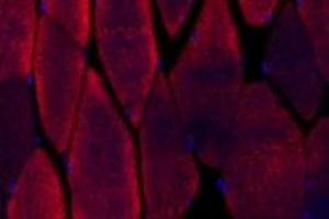 Immunofluorescent analysis of paraformaldehyde-fixed mouse muscle using alpha Actinin (ABIN7073023) at dilution of 1: 500