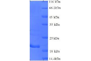 CTAG1B Protein (AA 1-180, full length) (His tag)