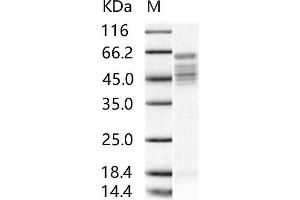 Western Blotting (WB) image for Respiratory Syncytial Virus Fusion Protein (RSV F) protein (His tag) (ABIN7198759) (RSV Fusion Protein Protein (His tag))