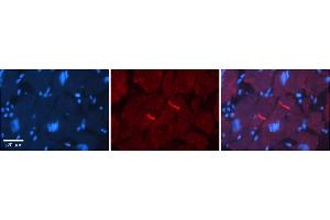 Immunohistochemistry (IHC) image for anti-gamma-aminobutyric Acid (GABA) Receptor, rho 2 (GABRR2) (Middle Region) antibody (ABIN2776135)