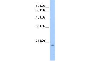 WB Suggested Anti-DNTTIP1 Antibody Titration:  2. (DNTTIP1 Antikörper  (N-Term))