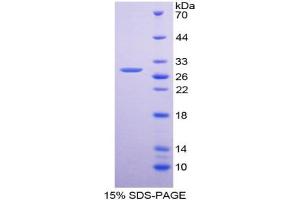SDS-PAGE (SDS) image for Platelet Derived Growth Factor Receptor alpha (PDGFRA) ELISA Kit (ABIN6720580)
