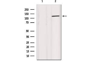 Western blot analysis of extracts from 293, using ATPase Antibody.