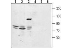 Western blot analysis of mouse kidney lysate (lanes 1 and 4), rat lung membrane (lanes 2 and 5) and human embryonic Kidney 293 cell lysate (lanes 3 and 6): - 1-3. (TPCN2 Antikörper  (2nd Lumenal Region))