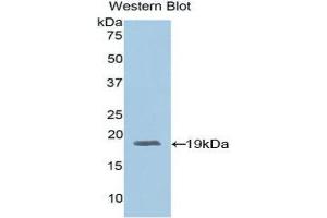 Western Blotting (WB) image for anti-Adrenomedullin (ADM) (AA 24-171) antibody (ABIN1857923) (Adrenomedullin Antikörper  (AA 24-171))