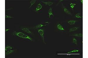 Immunofluorescence of purified MaxPab antibody to IMPDH2 on HeLa cell.