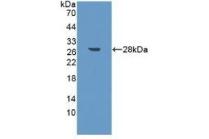 Detection of Recombinant FAPa, Mouse using Polyclonal Antibody to Fibroblast Activation Protein Alpha (FAPa) (FAP Antikörper  (AA 542-761))