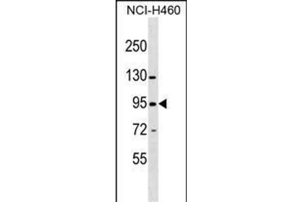 ZNF484 Antikörper  (N-Term)