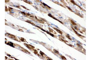 Anti- MAOA Picoband antibody,IHC(P) IHC(P): Rat Cardiac Muscle Tissue