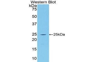 Western Blotting (WB) image for anti-Procollagen III N-Terminal Propeptide (PIIINP) (AA 34-272) antibody (Biotin) (ABIN1173224) (PIIINP Antikörper  (AA 34-272) (Biotin))