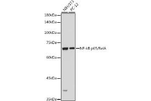Western blot analysis of extracts of various cell lines, using NF-kB p65/RelA antibody (ABIN6131885, ABIN6146861, ABIN6146863 and ABIN6215108) at 1:1000 dilution. (NF-kB p65 Antikörper  (AA 1-200))