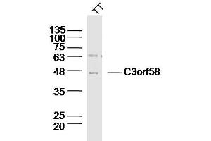 Human TT lysates probed with C3orf58 Polyclonal Antibody, Unconjugated  at 1:300 dilution and 4˚C overnight incubation. (C3orf58 Antikörper  (AA 351-430))