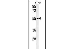 Western blot analysis of FA Antibody (C-term) (ABIN651345 and ABIN2840195) in mouse liver tissue lysates (35 μg/lane). (FAM151A Antikörper  (C-Term))