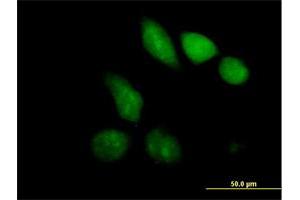 Immunofluorescence of purified MaxPab antibody to MBD1 on HeLa cell.