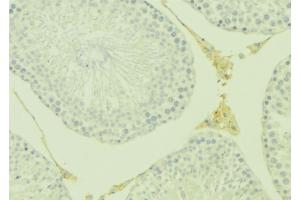 Immunohistochemistry (IHC) image for anti-Tumor Necrosis Factor Receptor Superfamily, Member 11b (TNFRSF11B) (Internal Region) antibody (ABIN6265637)