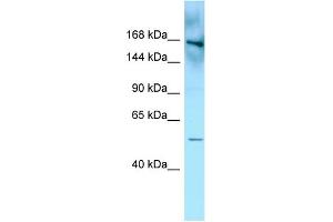 WB Suggested Anti-FYCO1 Antibody Titration: 1. (FYCO1 Antikörper  (N-Term))