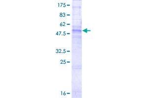 Image no. 1 for Gap Junction Protein, beta 1, 32kDa (GJB1) (AA 1-283) protein (GST tag) (ABIN1355137) (GJB1 Protein (AA 1-283) (GST tag))