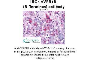 Image no. 1 for anti-Arginine Vasopressin Receptor 1B (AVPR1B) (Extracellular Domain), (N-Term) antibody (ABIN1732152) (AVPR1B Antikörper  (Extracellular Domain, N-Term))