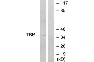 Western Blotting (WB) image for anti-TATA Box Binding Protein (TBP) (Internal Region) antibody (ABIN1849232) (TBP Antikörper  (Internal Region))