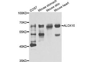 Western blot analysis of extracts of various cell lines, using ALOX15 antibody. (ALOX15 Antikörper)