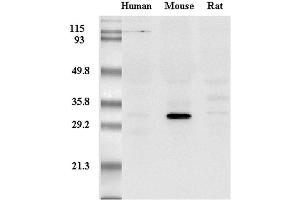 Western Blot analysis of adiponectin in mouse, human and rat plasma using anti-Adiponectin (mouse), mAb (MADI 1147)  at 0.