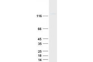 Validation with Western Blot