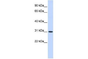 WB Suggested Anti-CYB5D2 Antibody Titration: 0. (CYB5D2 Antikörper  (N-Term))