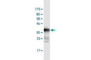 Western Blot detection against Immunogen (36. (DDX41 Antikörper  (AA 523-622))