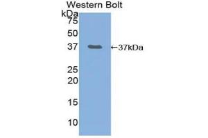 Detection of Recombinant NF2, Mouse using Polyclonal Antibody to Neurofibromin 2 (NF2) (Merlin Antikörper  (AA 30-311))