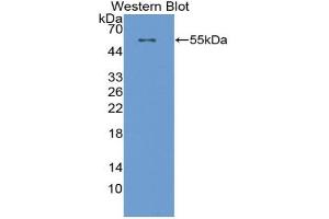 Western blot analysis of the recombinant protein. (CPT1A Antikörper  (AA 572-773))