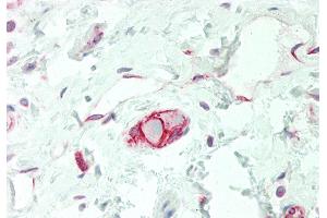 Immunohistochemistry (IHC) image for anti-Solute Carrier Family 38 Member 3 (SLC38A3) (N-Term) antibody (ABIN2775351)