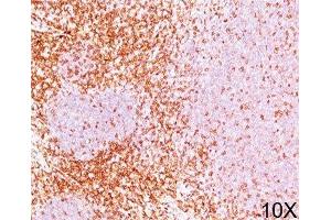 IHC testing of human tonsil stained with CD6 antibody (3F7B5). (CD6 Antikörper)