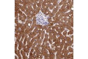 Immunohistochemical staining of human liver with PPP4R4 polyclonal antibody  shows strong cytoplasmic positivity in hepatocytes at 1:200-1:500 dilution. (PPP4R4 Antikörper)