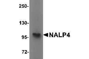 Western blot analysis of NALP4 in K562 cell lysate with NALP4 antibody at 1 µg/mL. (NLRP4 Antikörper  (Middle Region))