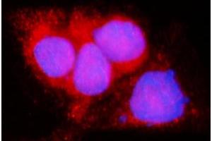 IF analysis of LACTB using anti-LACTB antibody (ABIN7600047).