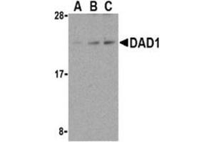 Western blot analysis of DAD1 in HepG2 cell lysate with AP30271PU-N DAD1 antibody at (A) 0.