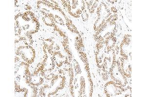 anti-Lamin B1 (LMNB1) (AA 450-500) antibody