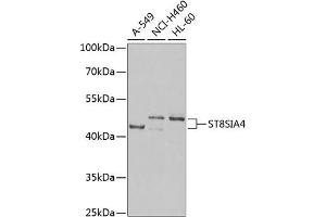 Western blot analysis of extracts of various cell lines, using ST8SI Antibody (ABIN6132840, ABIN6148545, ABIN6148546 and ABIN6222487) at 1:1000 dilution. (ST8SIA4 Antikörper  (AA 20-168))