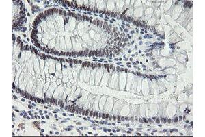 Image no. 5 for anti-Transducin-Like Enhancer of Split 1 (E(sp1) Homolog, Drosophila) (TLE1) (AA 180-460) antibody (ABIN1491050)