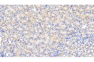 Detection of MCP1 in Mouse Kidney Tissue using Polyclonal Antibody to Monocyte Chemotactic Protein 1 (MCP1) (CCL2 Antikörper  (AA 24-96))