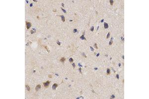 Immunohistochemistry of paraffin-embedded rat brain using PPP2R4 Antibody (ABIN5970981) at dilution of 1/200 (40x lens).