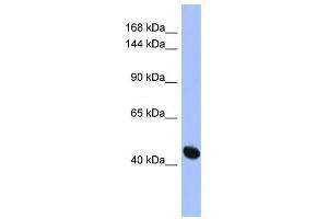RASGRF1 antibody used at 1 ug/ml to detect target protein.