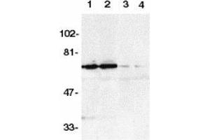 Western blot analysis of DR6 in K562 (1,3) and Raji (2,4) whole cell lysate in the absence (1,2) or presence (3,4) of blocking peptide with AP30301PU-N DR6 antibody at 1/500 dilution. (TNFRSF21 Antikörper  (AA 42-56))