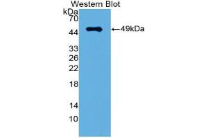 Western blot analysis of the recombinant protein. (IRF3 Antikörper  (AA 1-406))