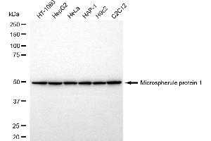 anti-Microspherule Protein 1 (MCRS1) antibody