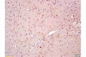 Formalin-fixed and paraffin embedded rat brain labeled with Anti-CNTF Polyclonal Antibody, Unconjugated (ABIN674229) at 1:200 followed by conjugation to the secondary antibody and DAB staining (CNTF Antikörper  (AA 21-150))